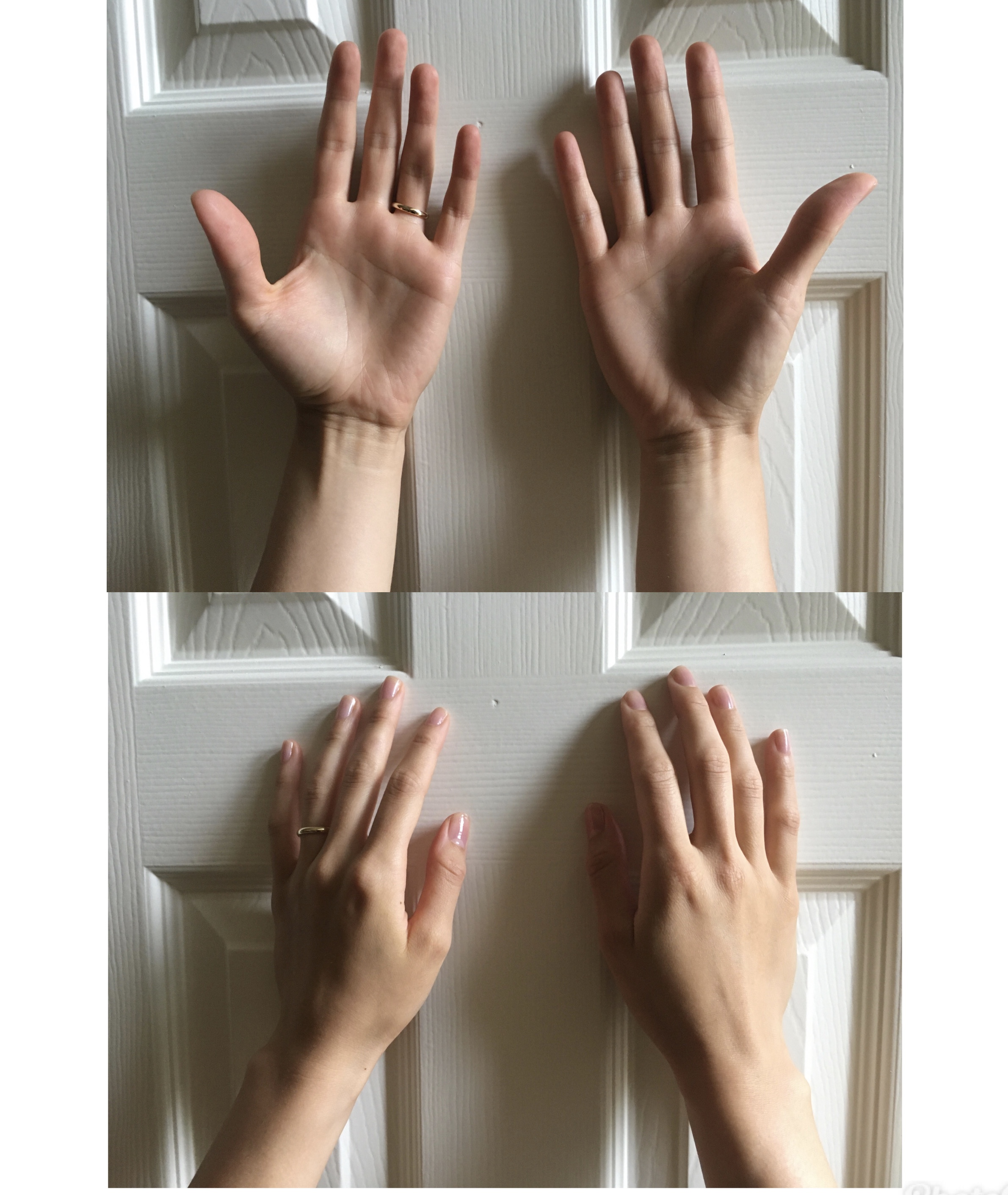 Hand Image